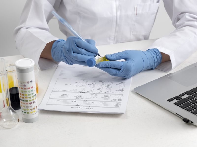 lab-doctor-performing-medical-exam-urine